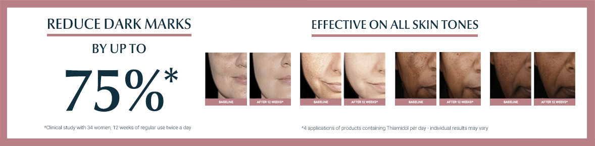 Even Pigment Perfector Uneven Skin Tone Eucerin even-pigment-perfector-uneven-skin-tone-eucerin